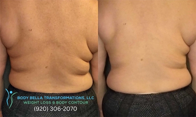 Weight Loss Green Bay WI Back Before And After