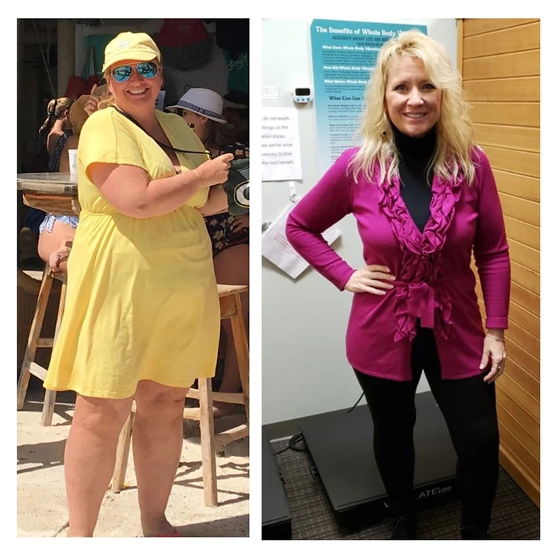 Weight Loss Green Bay WI Sandra Before and After